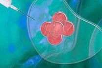 女性子宫肌瘤在长春市妇产医院做三代试管预算八万块够不够？